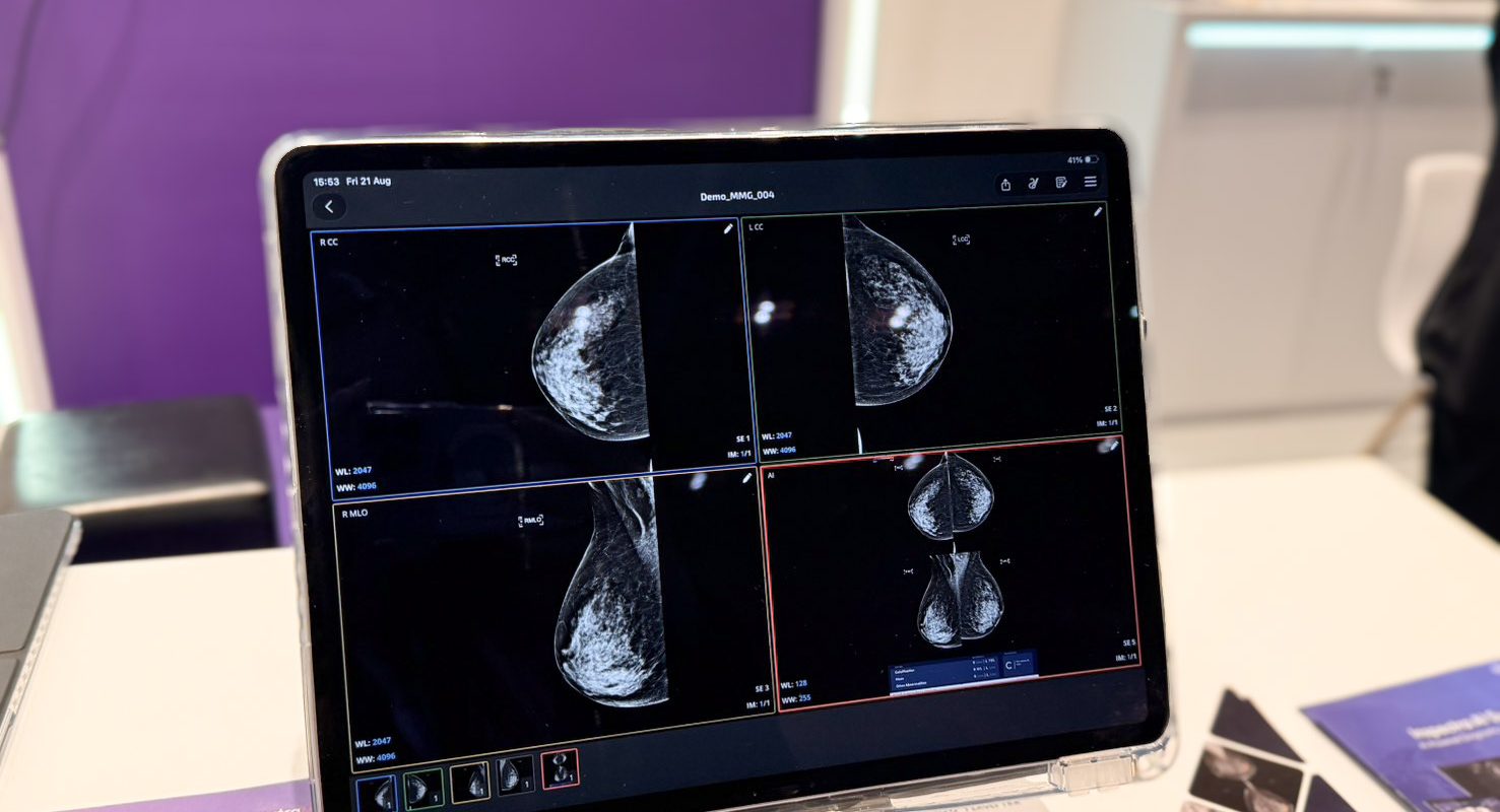 Perceptra, a Thai Startup, Brings Medical AI to International Markets to Enhance Regional Patient Screening